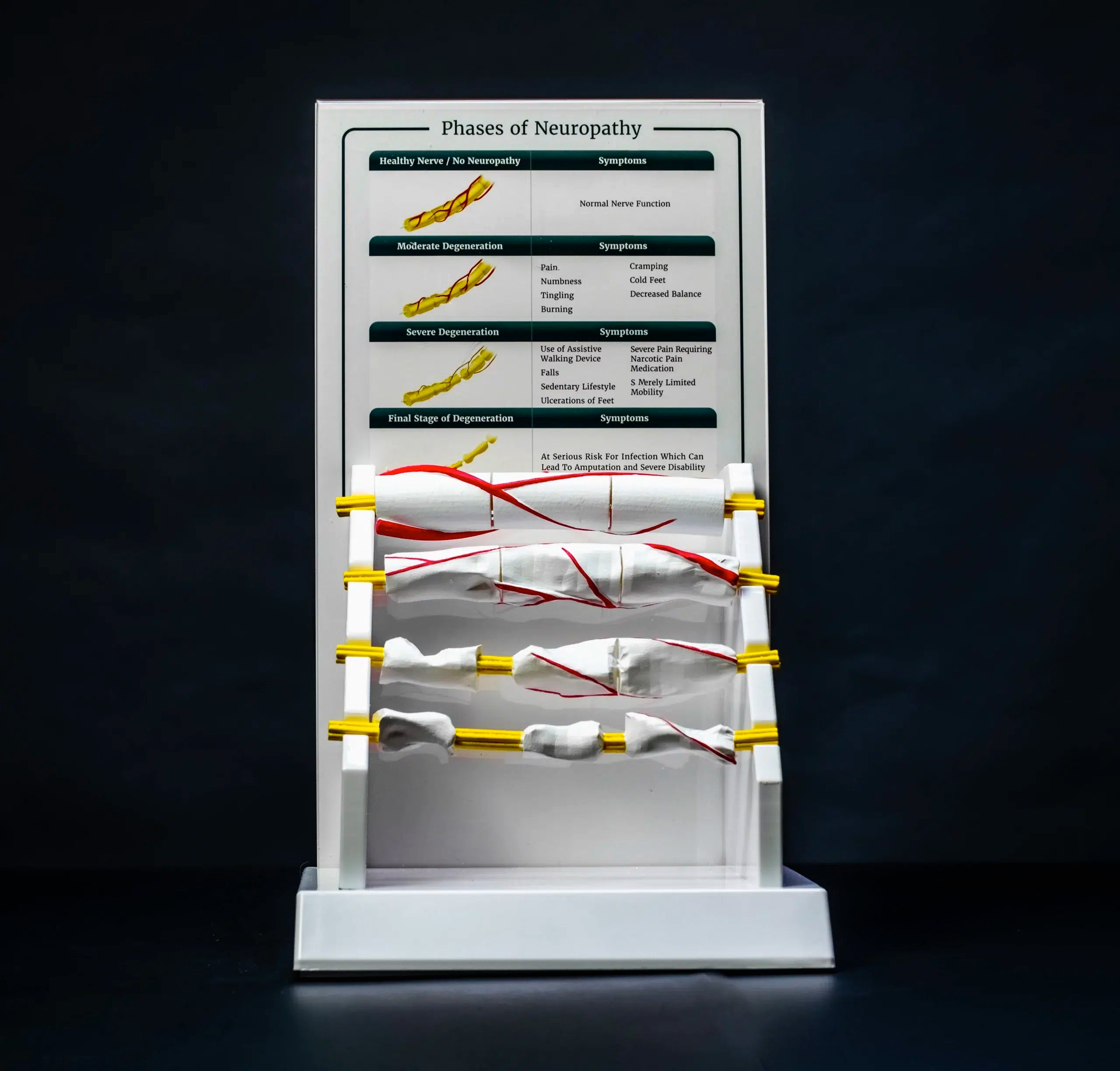 Bedrock Bioscience Nerve Anatomy Model – 3D Neuropathy Education Tool